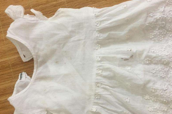 衣服发黑霉怎么办 第3张