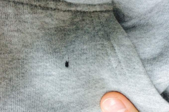 衣服染墨水怎么洗掉（衣服染墨水清洗的方法） 第5张