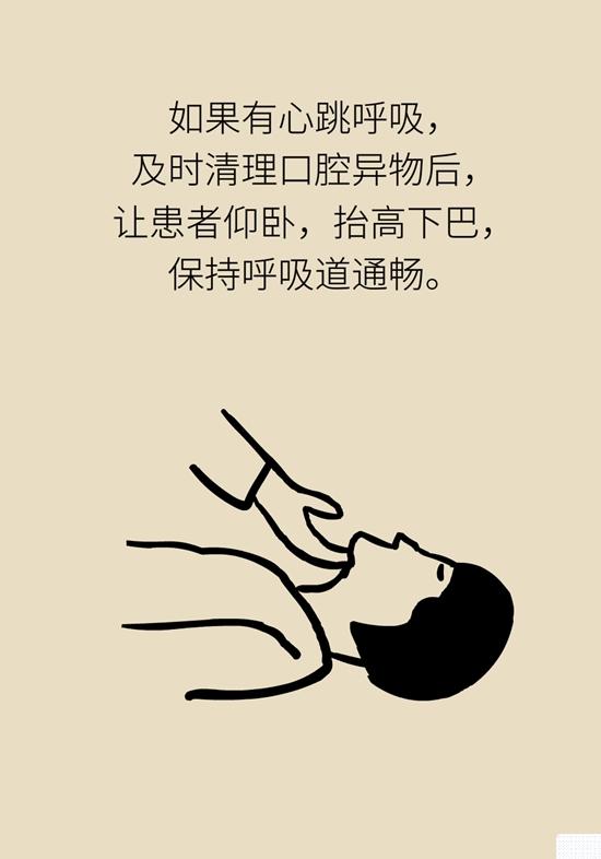 昏迷掐人中、浓茶解酒……这5个“医学常识”不对 第5张
