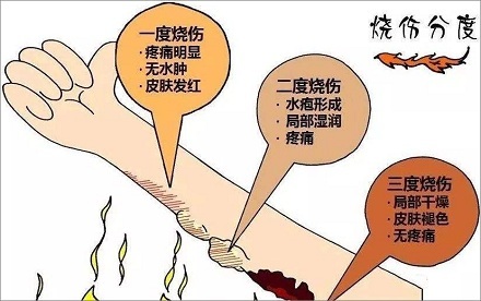 烫伤后的水泡究竟是什么？ 第3张