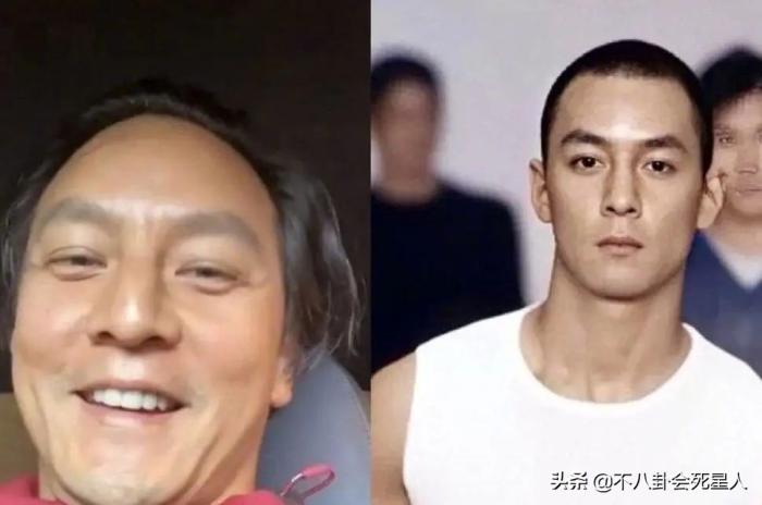 斗鸡眼、蒜头鼻、大扁嘴，这些明星看似神颜，实际五官缺陷好明显 第13张