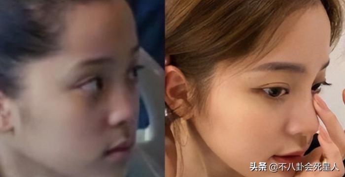 斗鸡眼、蒜头鼻、大扁嘴，这些明星看似神颜，实际五官缺陷好明显 第49张