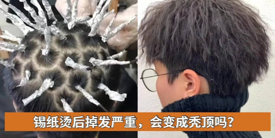 烫锡纸烫后掉发严重，会变成秃顶吗？看这三点就明白掉发的原因了 第1张