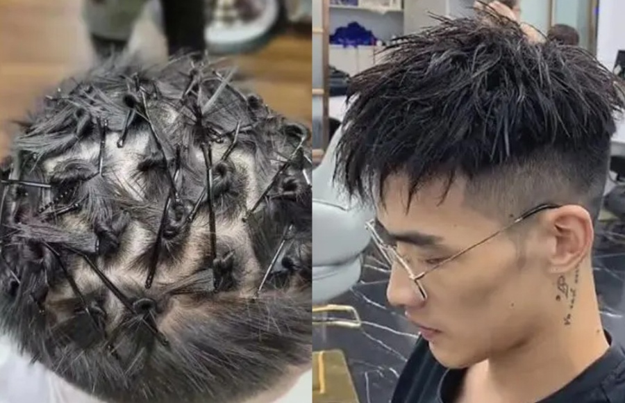 烫锡纸烫后掉发严重，会变成秃顶吗？看这三点就明白掉发的原因了 第13张