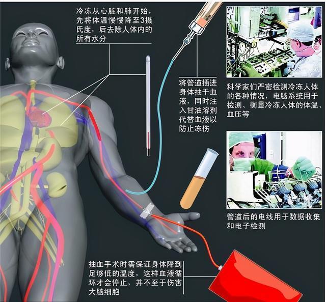 国内已有人体冷冻中心，10人选择，唯一重生机会，你会选择吗？ 第19张