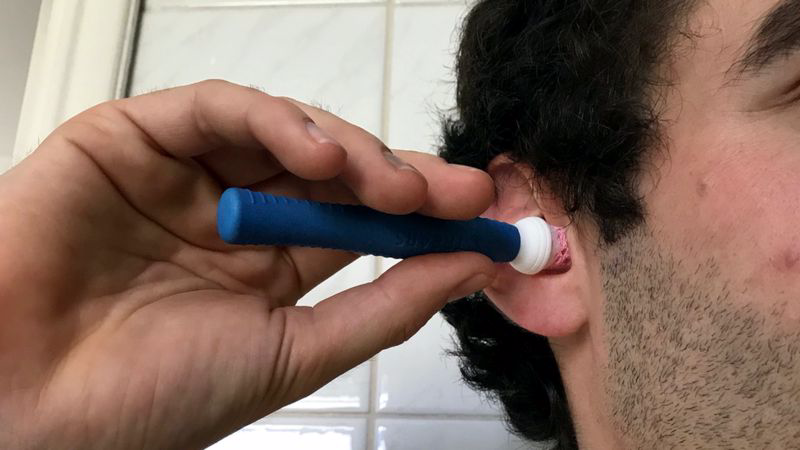 耳屎可以测出一个人压力有多大 第1张