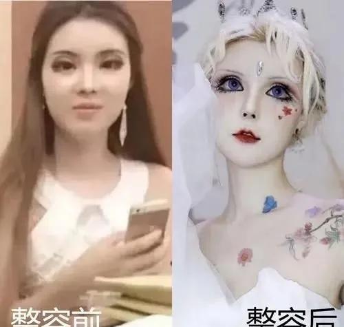芭比迪丽拉个人资料（花1000万整容108次） 第3张