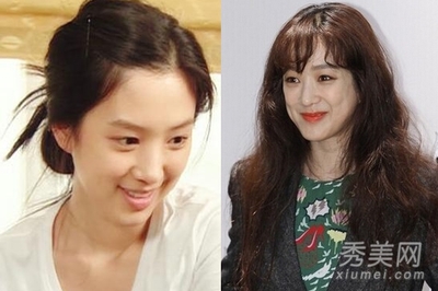 郑丽媛整容前后对比图 郑丽媛南太铉有孩子了吗 第3张
