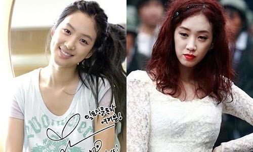 郑丽媛整容前后对比图 郑丽媛南太铉有孩子了吗 第5张