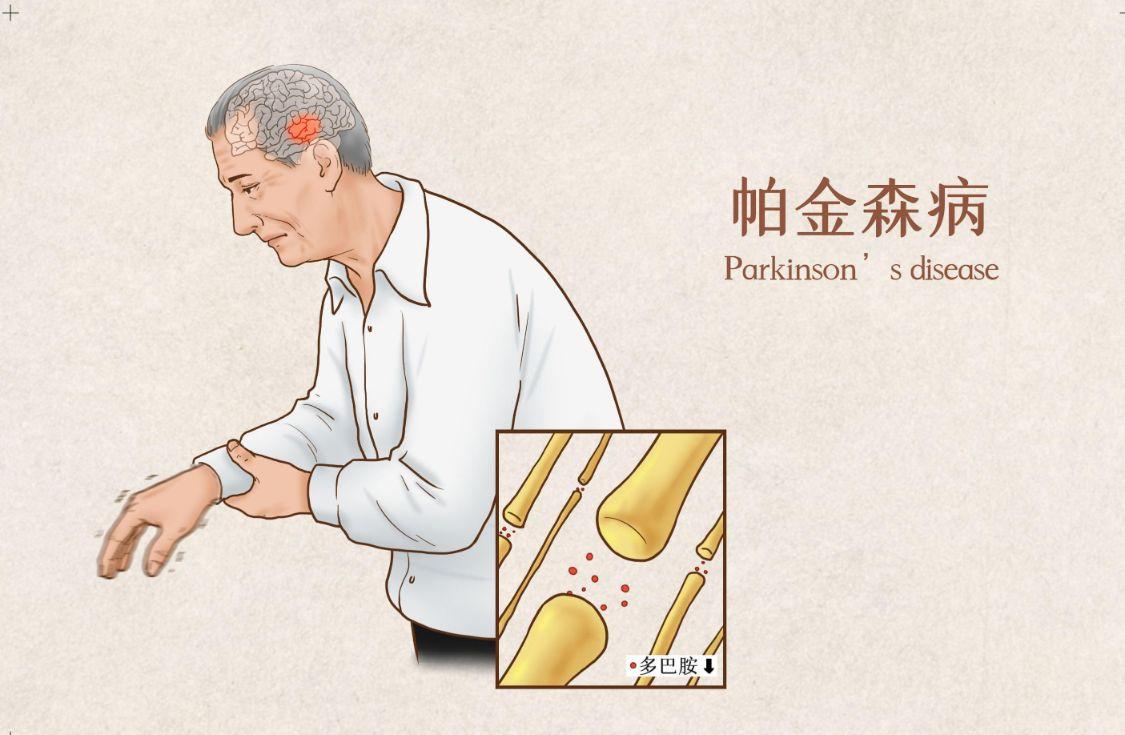 多巴胺的作用机理、代谢途径是怎样？了解3点，或许有帮助 第5张