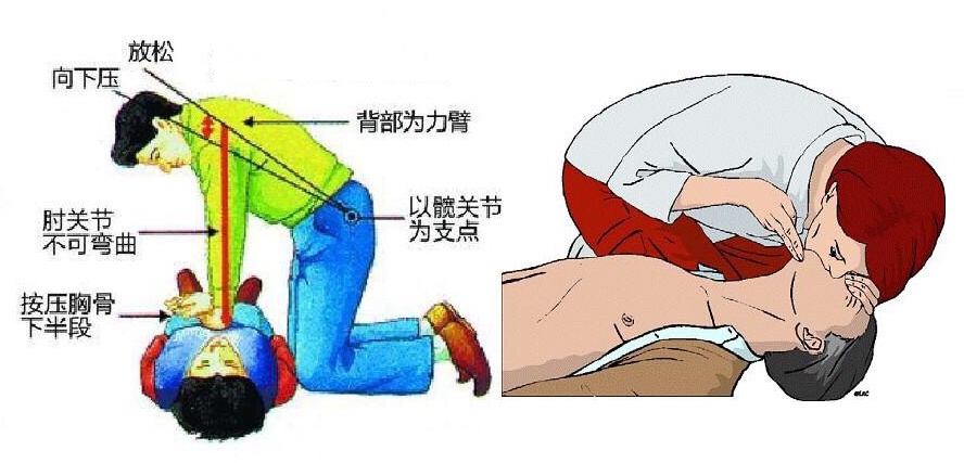 导致安倍晋三真正死亡的，可能不是刺客，而是错误施救的安保人员 第7张