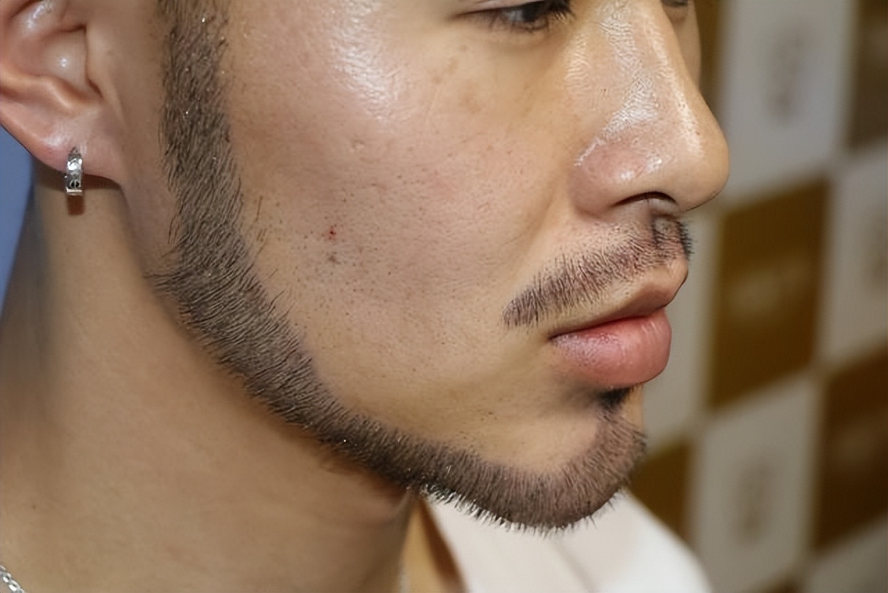 男性刮胡子频率高，代表了什么？天天刮胡子，会影响寿命吗？ 第5张