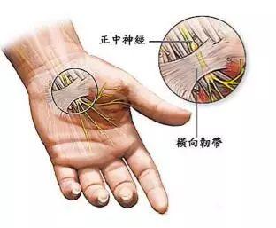 鼠标手怎么矫正最有效（鼠标手的快速康复方法） 第5张