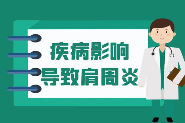 引起肩周炎的常见因素有这几个。 第5张