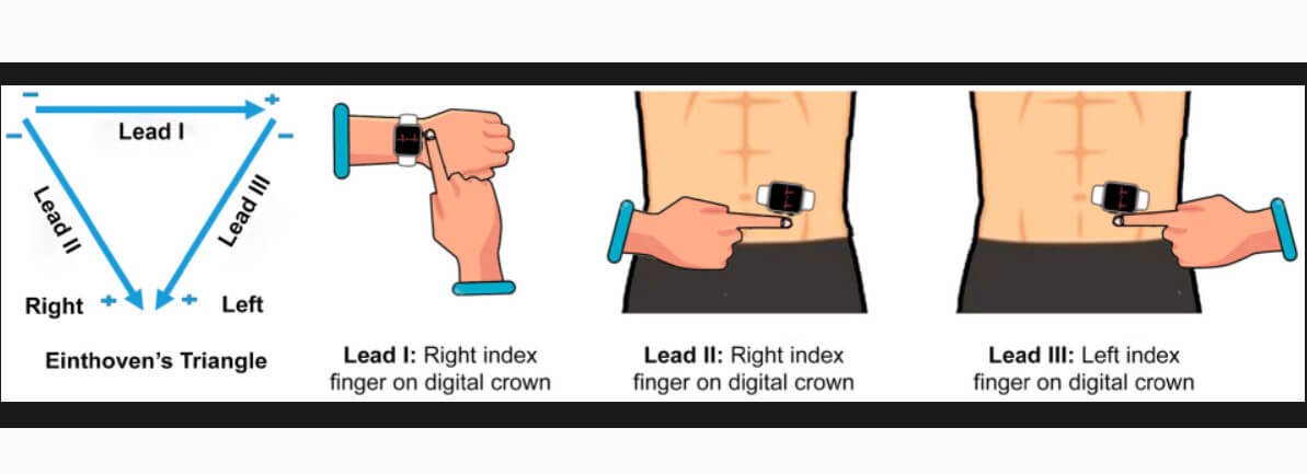 苹果Apple Watch具潜在检测心脏病发作能力？ 第3张