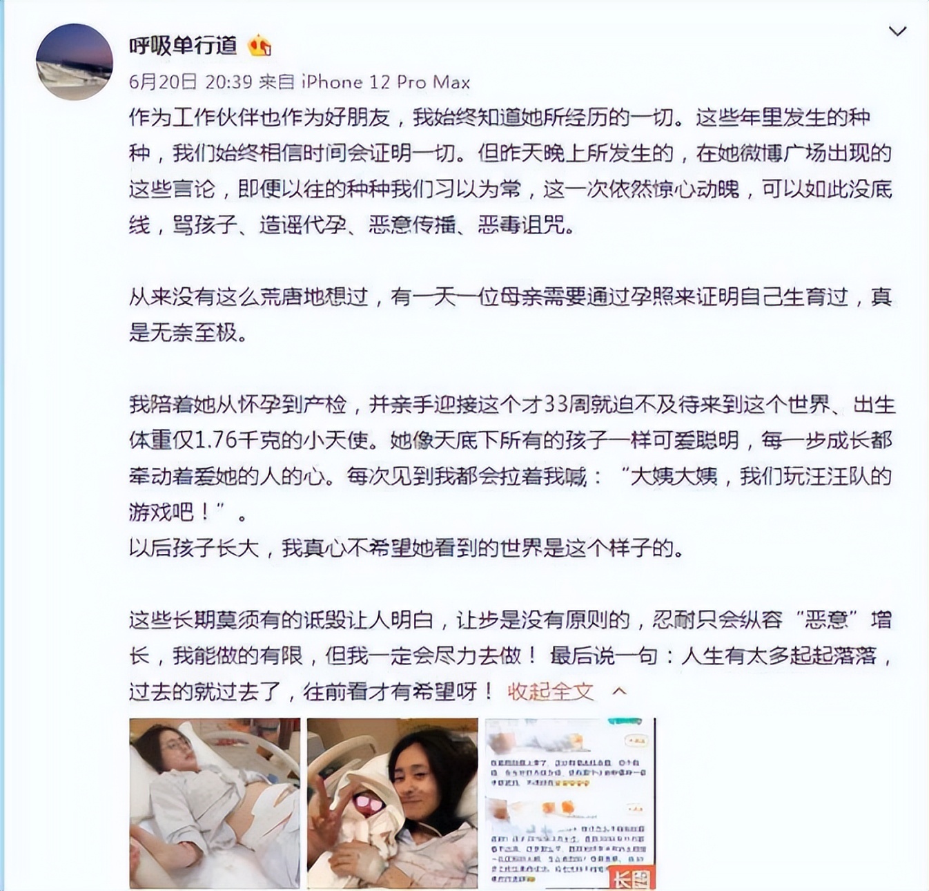 实力歌手张碧晨，做过练习生，当过私生饭，30岁成为单身妈妈 第49张
