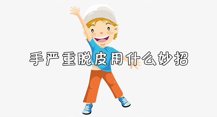 有什么方法可以解决手严重脱皮？ 第1张